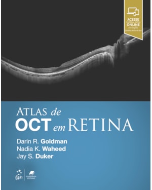 ATLAS DE OCT EM RETINA