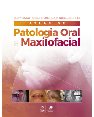 ATLAS DE PATOLOGIA ORAL E MAXILOFACIAL