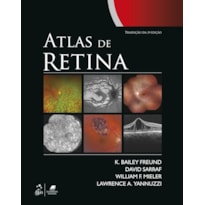 ATLAS DE RETINA