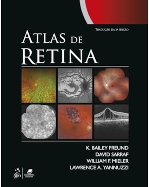 ATLAS DE RETINA