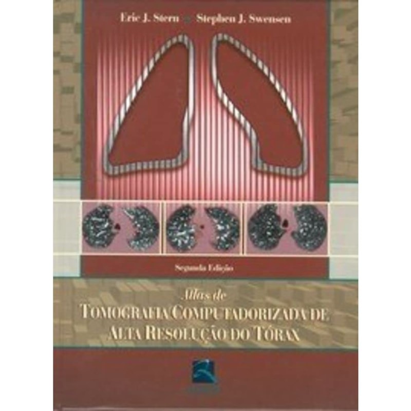 ATLAS DE TOMOGRAFIA COMPUTADORIZADA DE ALTA RESOLUÇÃO DO TÓRAX