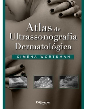 ATLAS DE ULTRASONOGRAFIA DERMATOLOGICA