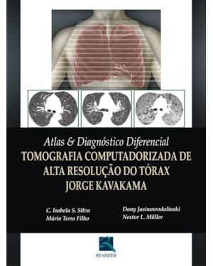 Atlas e diagnóstico diferencial: tomografia computadorizada de alta resolução do tórax - Jorge Kavakama