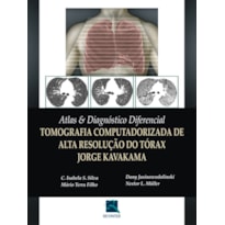 ATLAS & DIAGNÓSTICO DIFERENCIAL: TOMOGRAFIA COMPUTADORIZADA DE ALTA RESOLUÇÃO DO TÓRAX JORGE KAVAKAMA