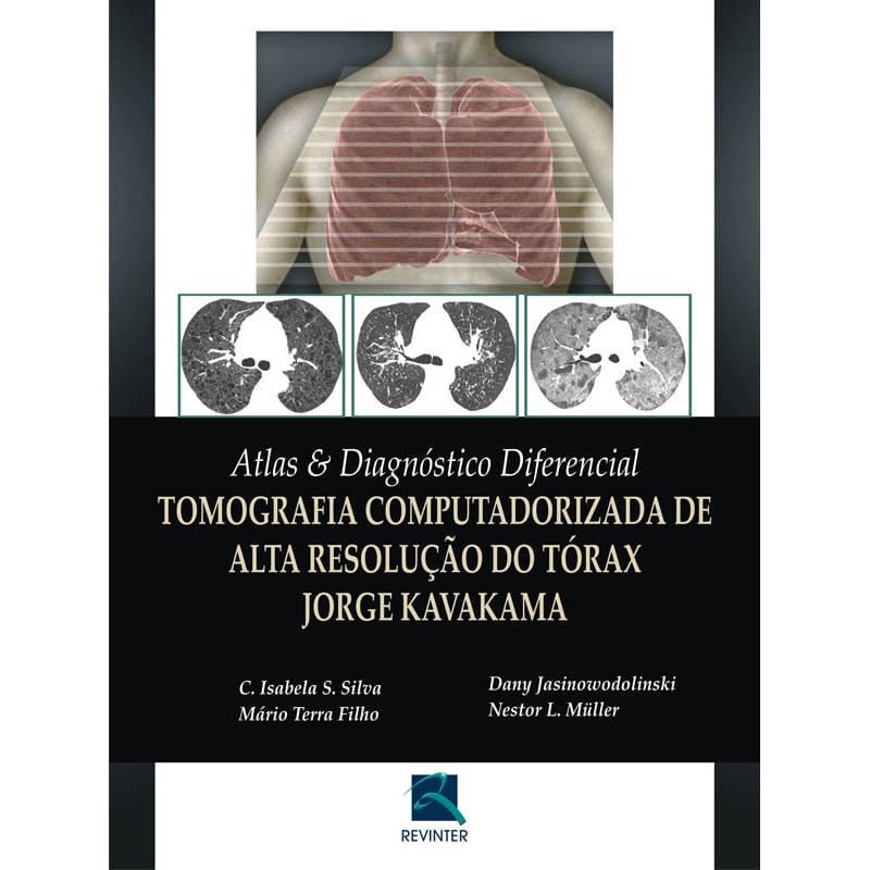 ATLAS & DIAGNÓSTICO DIFERENCIAL: TOMOGRAFIA COMPUTADORIZADA DE ALTA RESOLUÇÃO DO TÓRAX JORGE KAVAKAMA
