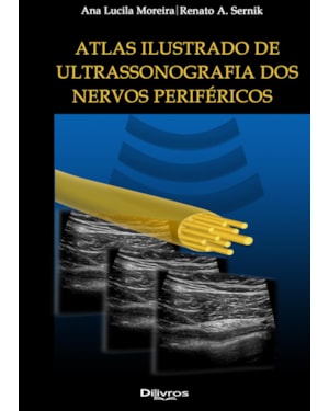 ATLAS ILUSTRADO ULTRASSONOGRAFIA DOS NERVOS PERIFÉRICOS
