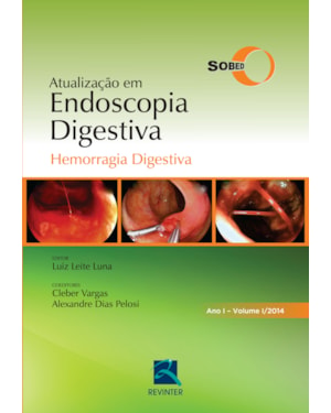 Atualização em endoscopia digestiva: hemorragia digestiva