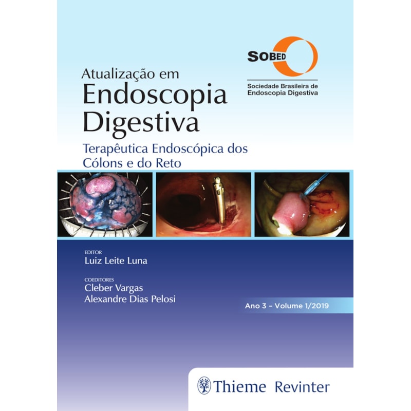 Atualização em endoscopia digestiva: terapêutica endoscópica dos cólons e do reto - Ano 3