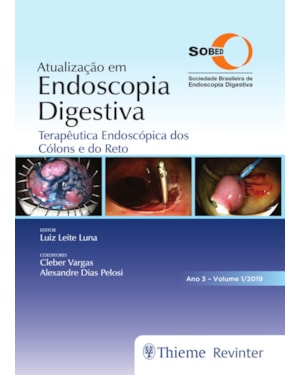 Atualização em endoscopia digestiva: terapêutica endoscópica dos cólons e do reto - Ano 3