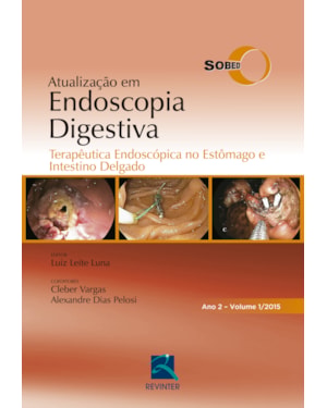 Atualização em endoscopia digestiva: terapêutica endoscópica no estômago e intestino delgado - Ano 2