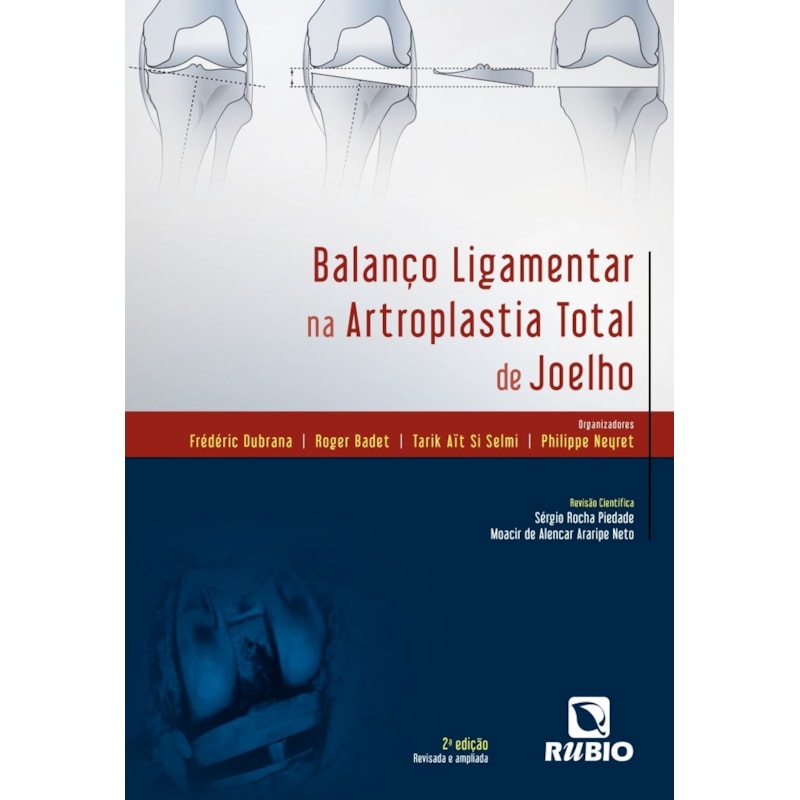 BALANCO LIGAMENTAR NA ARTROPLASTIA TOTAL DE JOELHO - 2