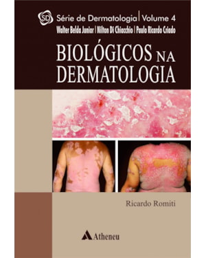 Biológicos na dermatologia