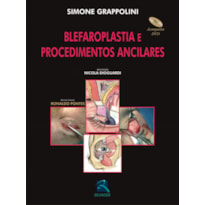 BLEFAROPLASTIA E PROCEDIMENTOS ANCILARES