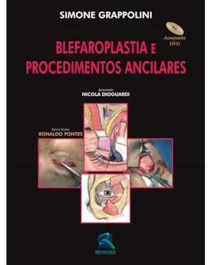 Blefaroplastia e procedimentos ancilares