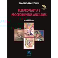 BLEFAROPLASTIA E PROCEDIMENTOS ANCILARES BLEFAROPLASTIA E PROCEDIMENTOS ANCILARES