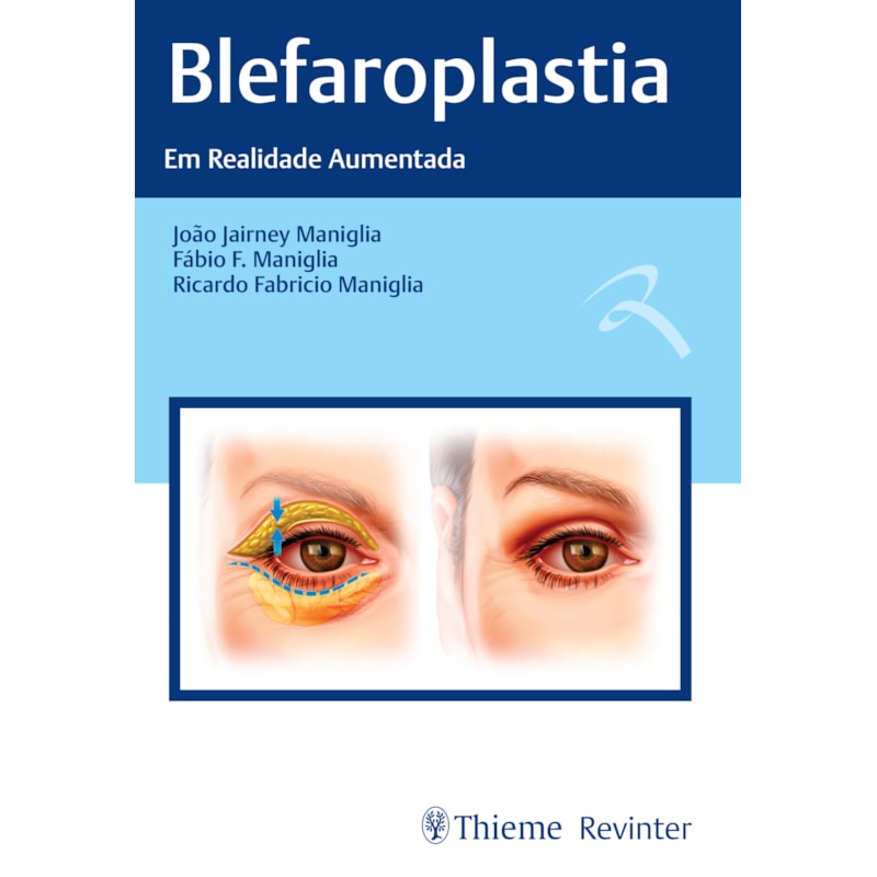 BLEFAROPLASTIA: EM REALIDADE AUMENTADA