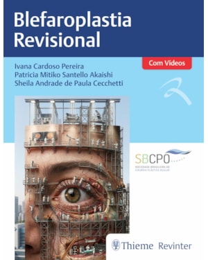Blefaroplastia Revisional