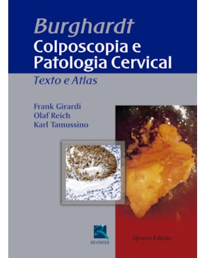 Burghardt - Colposcopia e Patologia Cervical: Texto e Atlas