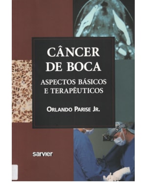 CÂNCER DE BOCA