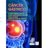 CÂNCER GÁSTRICO
