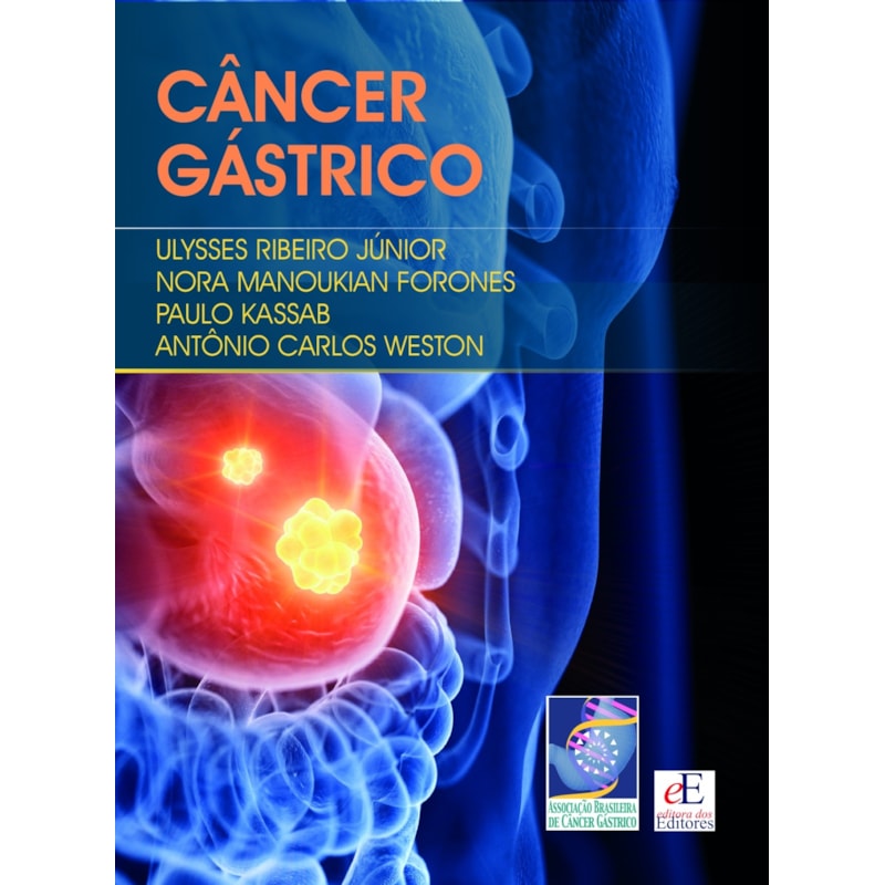 CÂNCER GÁSTRICO