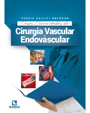 Casos comentados de cirurgia vascular e endovascular