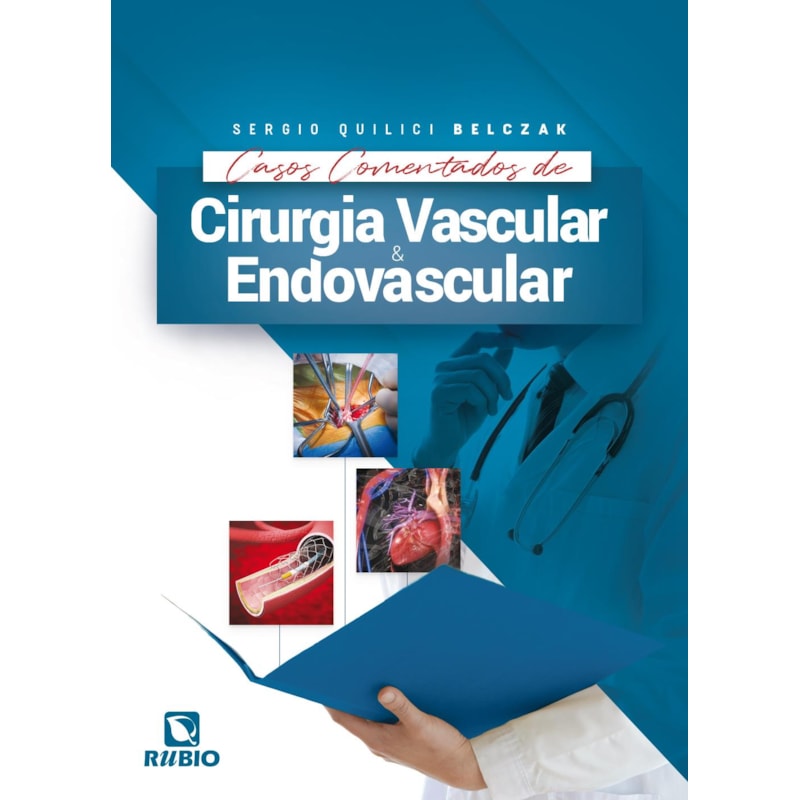 CASOS COMENTADOS DE CIRURGIA VASCULAR E ENDOVASCULAR
