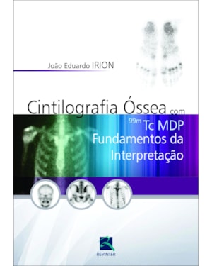 Cintilografia Óssea com 99m Tc MDP: Fundamentos da Interpretação
