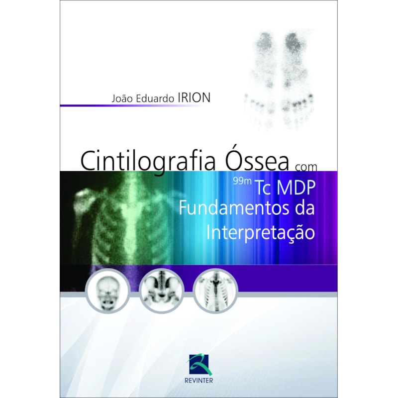 CINTILOGRAFIA ÓSSEA COM 99M TC MDP: FUNDAMENTOS DA INTERPRETAÇÃO
