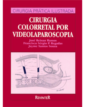 CIRURGIA COLORRETAL POR VIDEOLAPAROSCOPIA