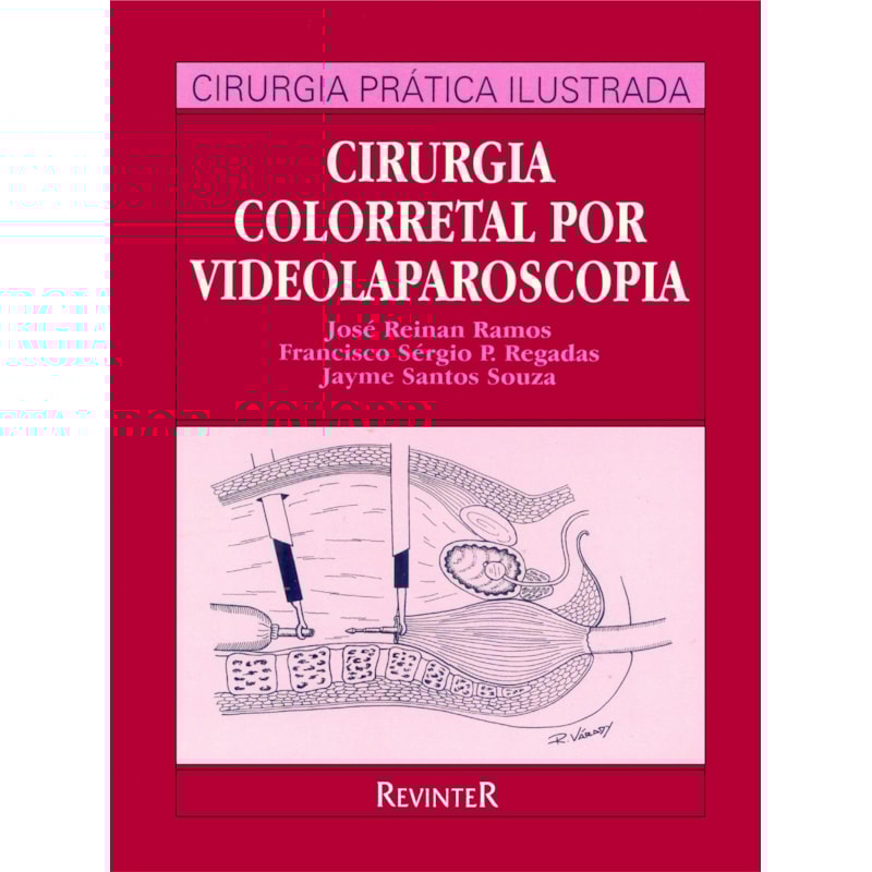 CIRURGIA COLORRETAL POR VIDEOLAPAROSCOPIA