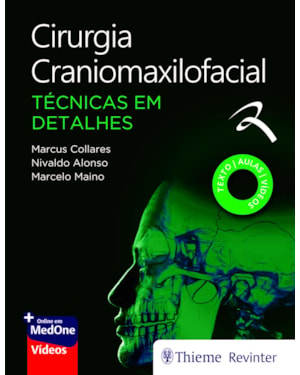Cirurgia Craniomaxilofacial: Técnicas em Detalhes