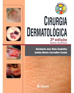 Cirurgia dermatologica