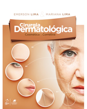 CIRURGIA DERMATOLÓGICA COSMÉTICA & CORRETIVA