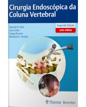 Cirurgia endoscópica da coluna vertebral
