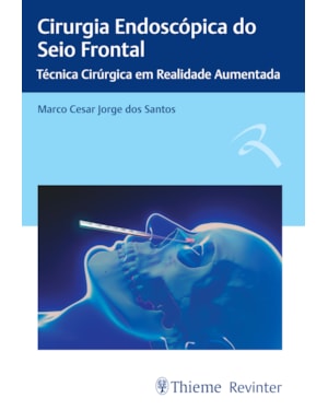 Cirurgia endoscópica do seio frontal