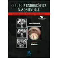 Cirurgia endoscópica nasossinusal