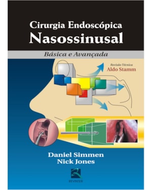 Cirurgia endoscópica nasossinusal: básica e avançada