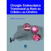 Cirurgia endoscópica transnasal da base do crânio e do cérebro