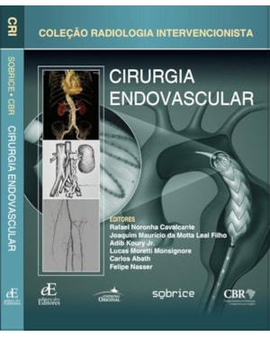 CIRURGIA ENDOVASCULAR: COLEÇÃO RADIOLOGIA INTERVENCIONISTA