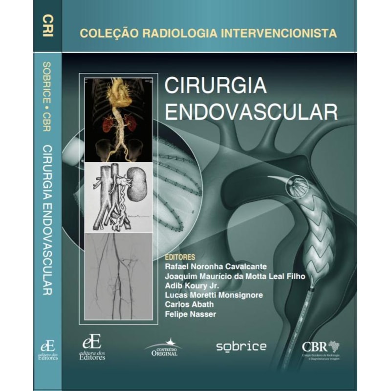 CIRURGIA ENDOVASCULAR: COLEÇÃO RADIOLOGIA INTERVENCIONISTA