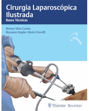 Cirurgia laparoscópica ilustrada: bases técnicas