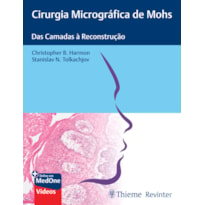 CIRURGIA MICROGRÁFICA DE MOHS: DAS CAMADAS À RECONSTRUÇÃO