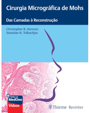 Cirurgia micrográfica de mohs: das camadas à reconstrução