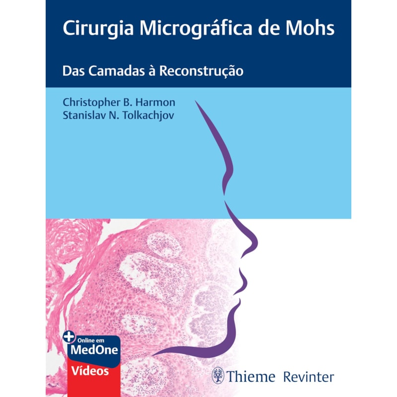 CIRURGIA MICROGRÁFICA DE MOHS: DAS CAMADAS À RECONSTRUÇÃO