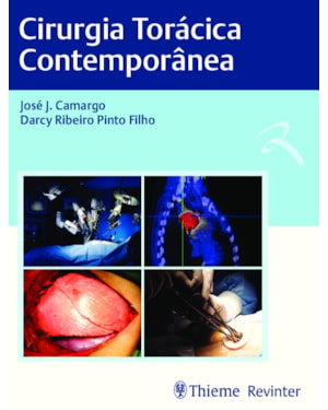 Cirurgia torácica contemporânea