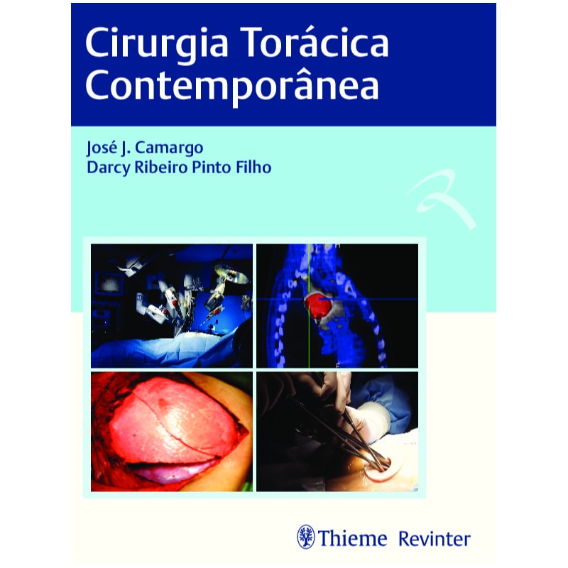 CIRURGIA TORÁCICA CONTEMPORÂNEA