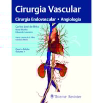 Cirurgia vascular: cirurgia endovascular, angiologia