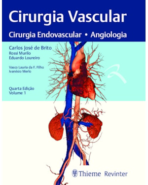 Cirurgia vascular: cirurgia endovascular, angiologia