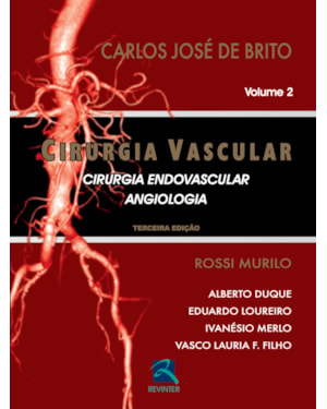 Cirurgia vascular: cirurgia endovascular - Angiologia